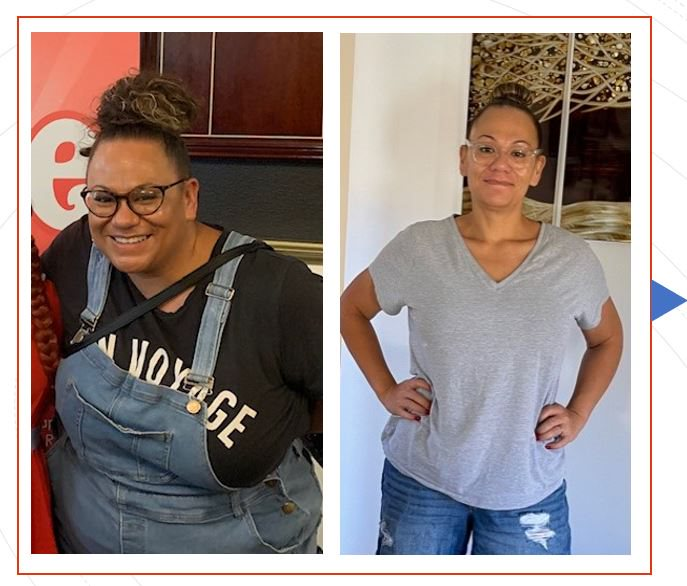 before and after weight loss